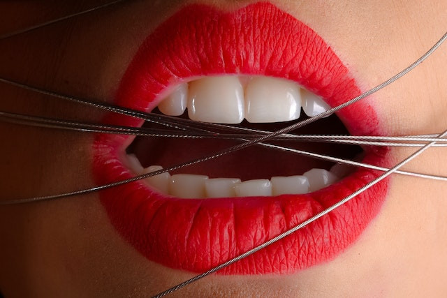 What is the "gag law"?